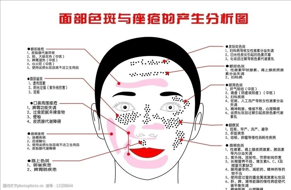 面部色斑与痤疮的产生分析图图片