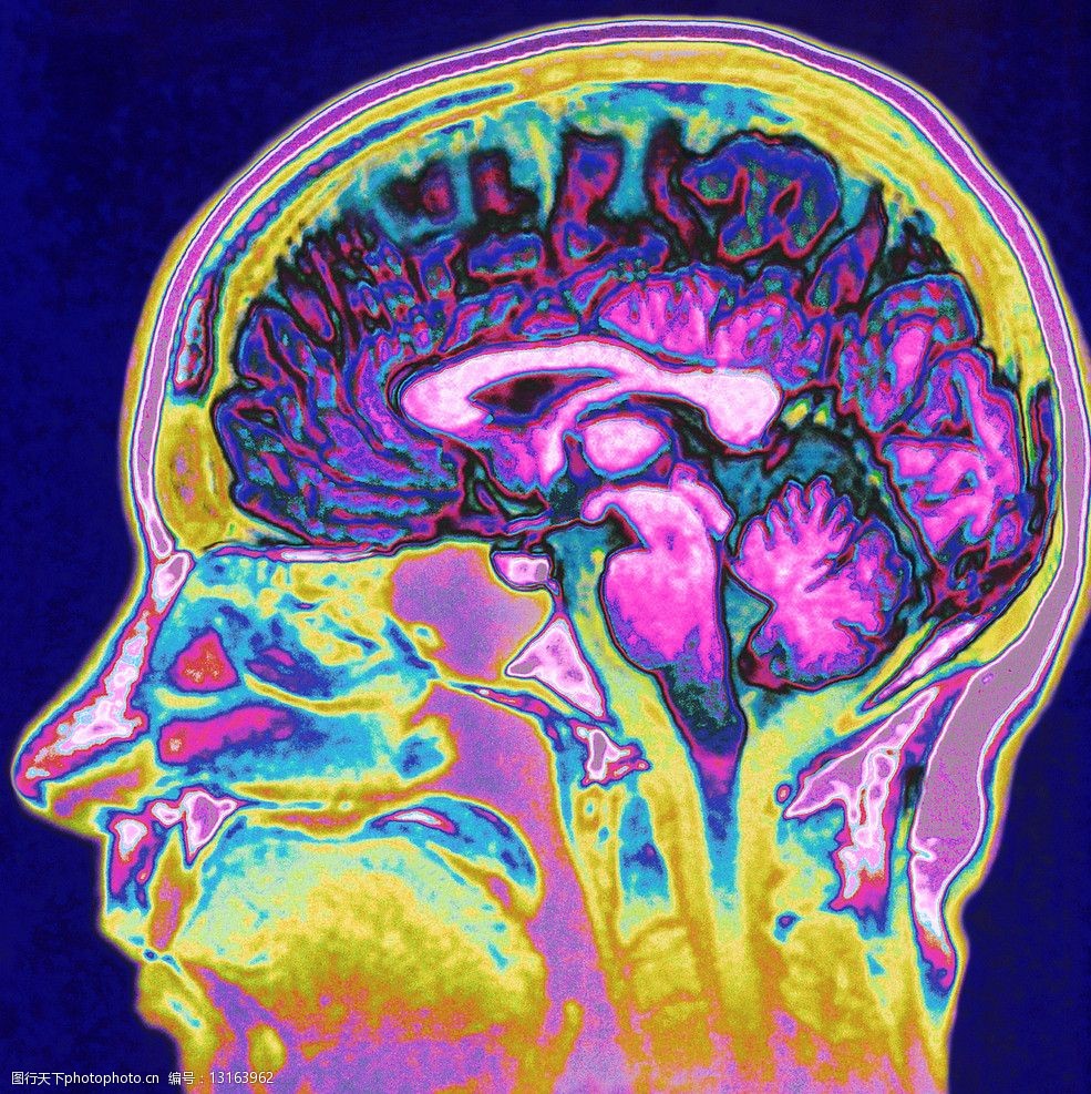 脑部构造图片